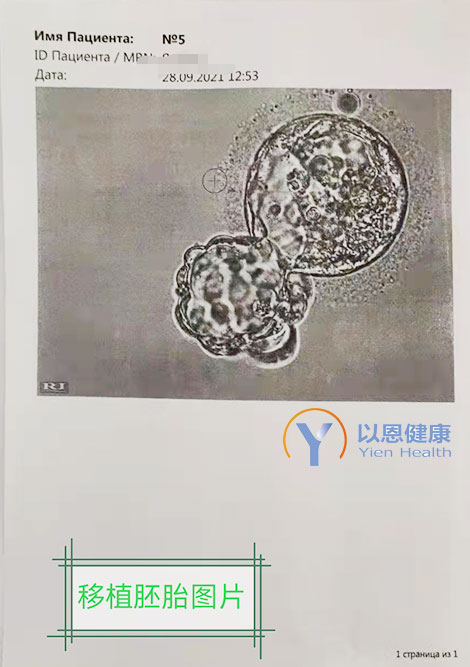 以恩健康：移植活产率大于90%